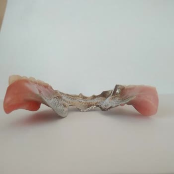 İzmir Eğitim Diş Hastanesi Hatalı Protez Yapımı.