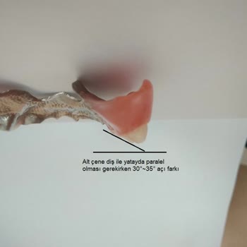 İzmir Eğitim Diş Hastanesi Hatalı Protez Yapımı.