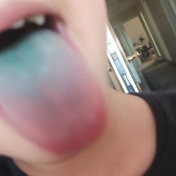 Kızılay Maden Suyu Frenk Karadut İçeriği