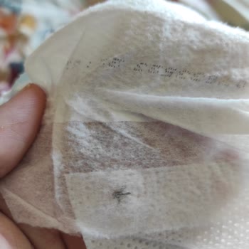 Molfix Bebek Bezi Sivrisinek Çıktı