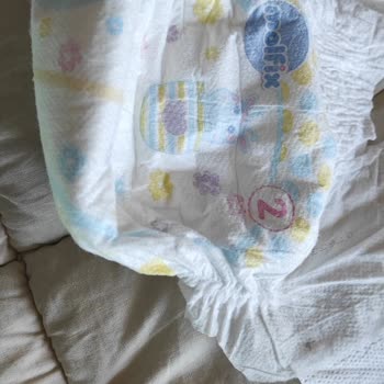 Molfix Bebek Bezi Sivrisinek Çıktı