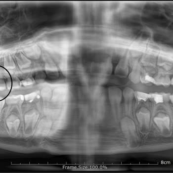 Hospitadent Diş Hastanesi Pedodontist Hatası Sonrası İlgisizlik