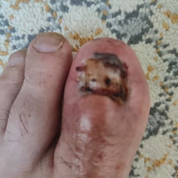 Allianz Sigorta Yüzünden Sakat Kaldım