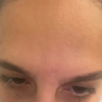 Yves Rocher Anti AGE Global Gündüz Yüz Kremi Yüzüme Sivilce Yaptı!