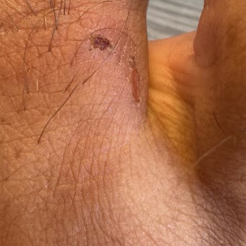 Calvin Klein Kötü Malzeme Ve Kalıp