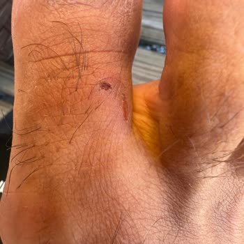 Calvin Klein Kötü Malzeme Ve Kalıp