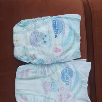 BİM Den Aldığım Molfix Bez Sahte Çıktı