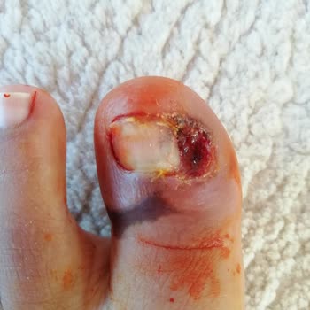 Climed Tedavi Merkezi Tırnak Batığı