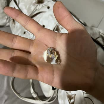 Magnum Mini Bademli Dondurmadan Kadın Saç Kılı Çıkması