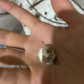 Magnum Mini Bademli Dondurmadan Kadın Saç Kılı Çıkması