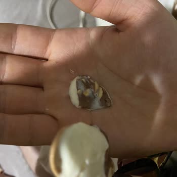 Magnum Mini Bademli Dondurmadan Kadın Saç Kılı Çıkması