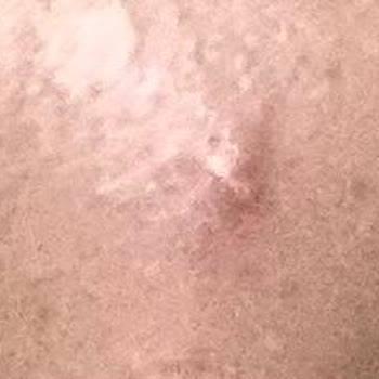 Note Cosmetics Note BB Cream Sivilce Yaptı,