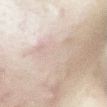 Note Cosmetics Note BB Cream Sivilce Yaptı,