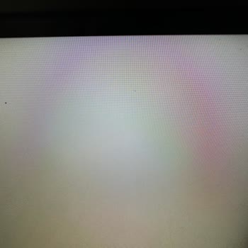 Philips TV 65PUS8887 Ölü Piksel Sorunu