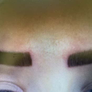 Neslim Güngen Güzellik Kağıthane Neslin Güngen Hatalı Kaş Micro Ve Pudralama İşlemi