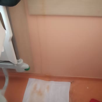 Ümraniye Eğitim ve Araştırma Hastanesi Hijyensiz Bakımsız Oda