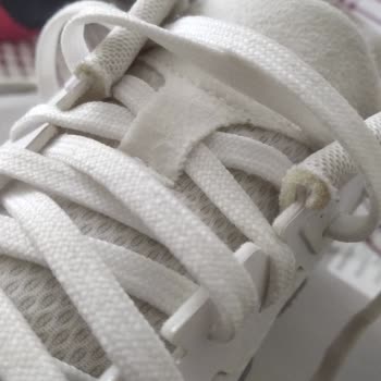 Ozdilekteyim.com Adidas Marka Ayakkabı 3 Ayda Bu Hale Geldi