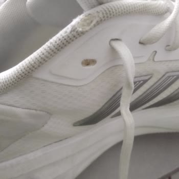Ozdilekteyim.com Adidas Marka Ayakkabı 3 Ayda Bu Hale Geldi