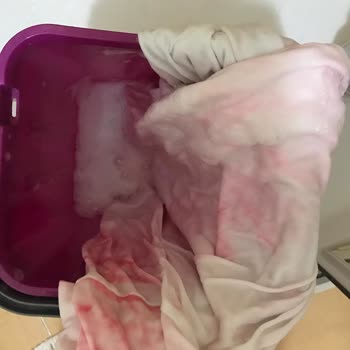 Ace Çamaşır Suyu Pembeye Boyadı