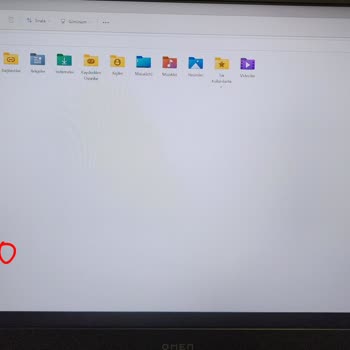 HP Ölü Piksel Sorunu