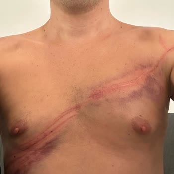 Sarıyer Belediyesi Bisiklet Parkuru Jilet