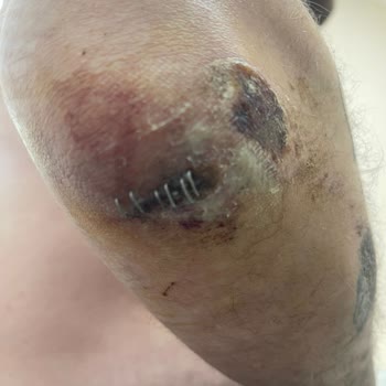 Corpus Sigorta'ya Hakkım Helal Olmasın.