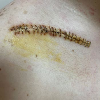 Corpus Sigorta'ya Hakkım Helal Olmasın.