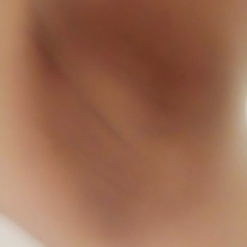 Gold Queen Estetik Koltuk Altı Kararması