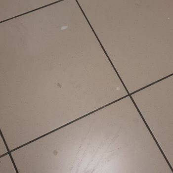 Abant İzzet Baysal Tıp Fakültesi Hastanesi Temizlik Hijyen Mikrop Yuvası