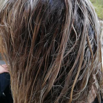 Taha Bozan Hair Palace Yanlış Ve Eksik Hizmet