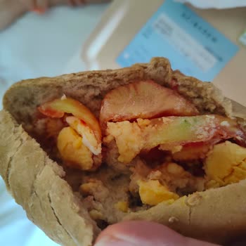 Acıbadem Hastanesi Onkolojide Çocuk Yemek Sorunu