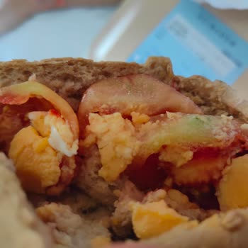 Acıbadem Hastanesi Onkolojide Çocuk Yemek Sorunu