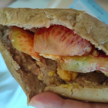 Acıbadem Hastanesi Onkolojide Çocuk Yemek Sorunu