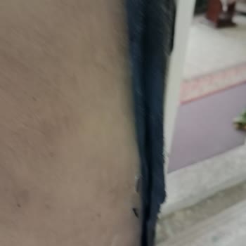 Savaş Mobilya A101 Aktüel Ürünleri Koltukları Sorunu