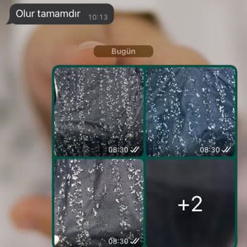 Dufaofficial Elbise Taş Dökülmesi İade