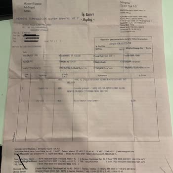 Mercedes Eqc 400 Direksiyon Simidi Soyulması