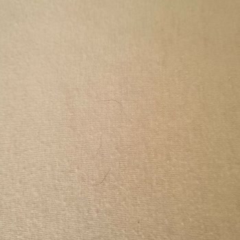 Palmira Hotel Kuşadası Otel Kirliliği Ve Çalışanların İlgisizliği