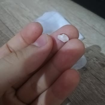 Kervan Pastaneleri Pastanın İçinden Çıkan Yabancı Cisim