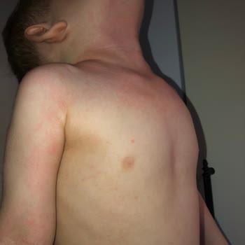 Dalin Likit Pudra Memnuniyetsizliği