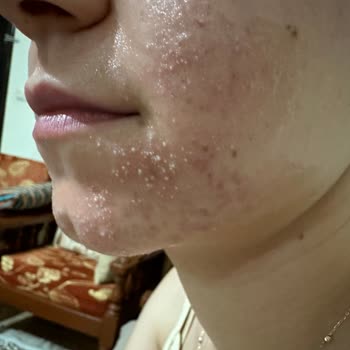 Garnier C Vitamini Serumu