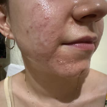 Garnier C Vitamini Serumu