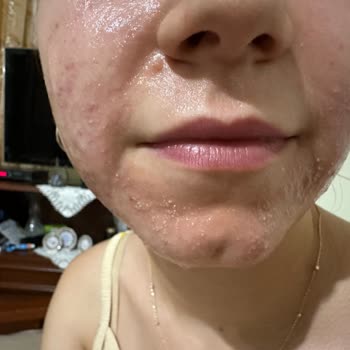 Garnier C Vitamini Serumu