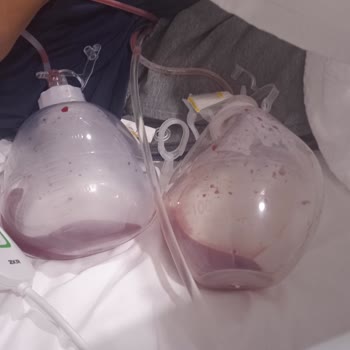 Sağlık Bakanlığı Ankara Etlik Hastanesi Kvc Bölümü