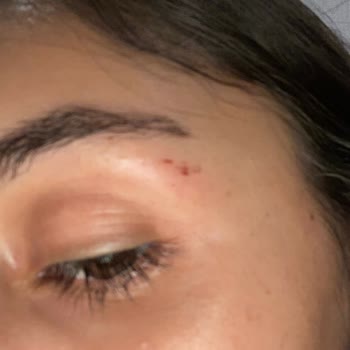 Watsons Alsancak Şubesi Beuty Bar Sorunu