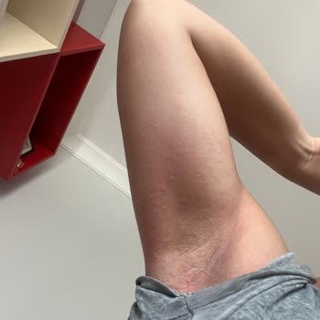 Tereson Cildimi Mahvetti Umarım Gereği Yapılır!