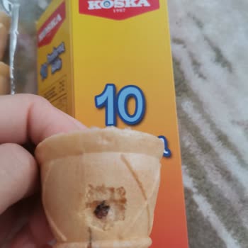 Koska Nazar Boncuklu Külah İçinden Yabancı Cisim Çıktı