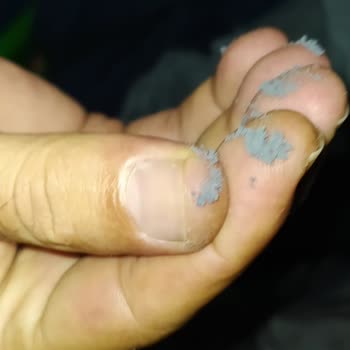 Arçelik Çamaşır Makinesi Arızası Ve Servisin İlgisizliği
