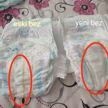 Molfix Düşük Kalitede Bez