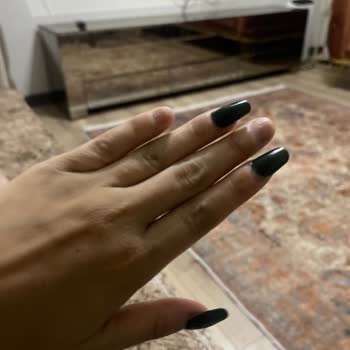 Aymira Koçaklı Yaşam Merkezi Kapsül Tırnak Çıkması