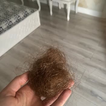 Ertan Gülpınar Saçlarımı Yaktı